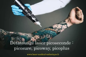Détatouage laser picoseconde picosure