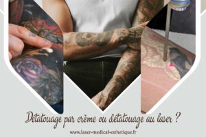 Détatouage microblading Détatouage par crème ou détatouage au laser