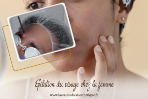 Epilation du visage chez la femme