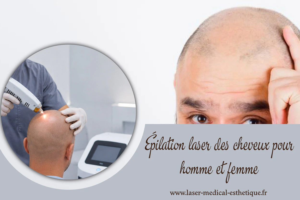 Épilation laser des cheveux pour homme et femme Épilation laser des cheveux pour homme et femme