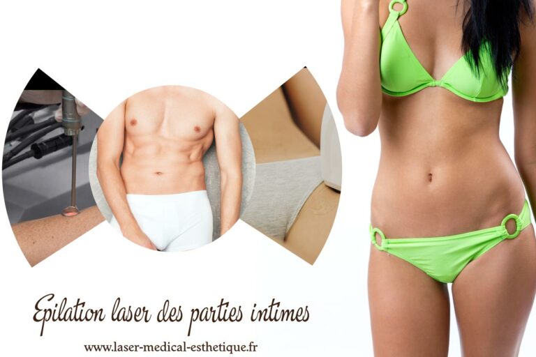 Epilation laser des parties intimes