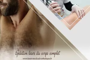 Épilation laser du corps complet