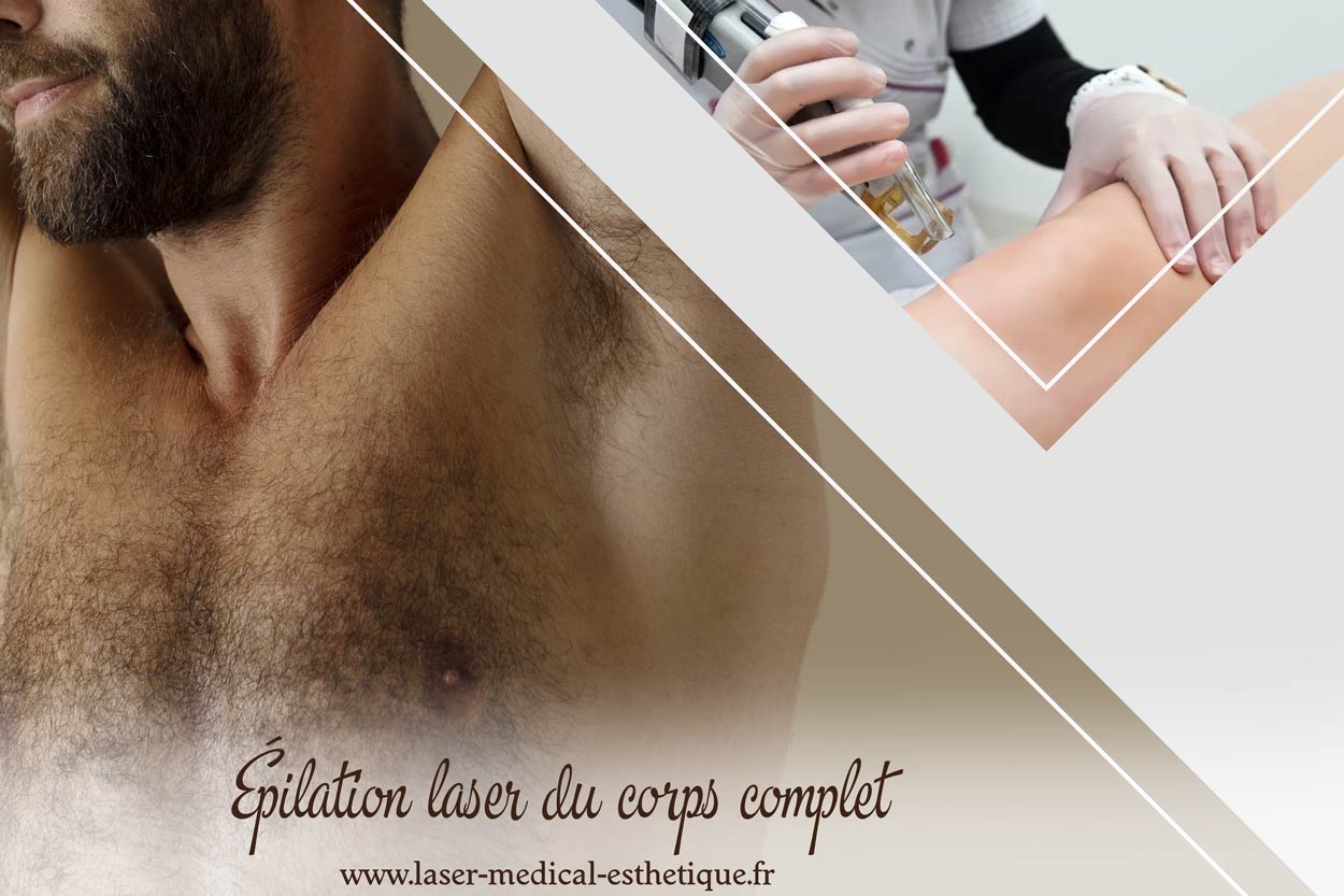 Épilation laser du corps complet Épilation laser du corps complet