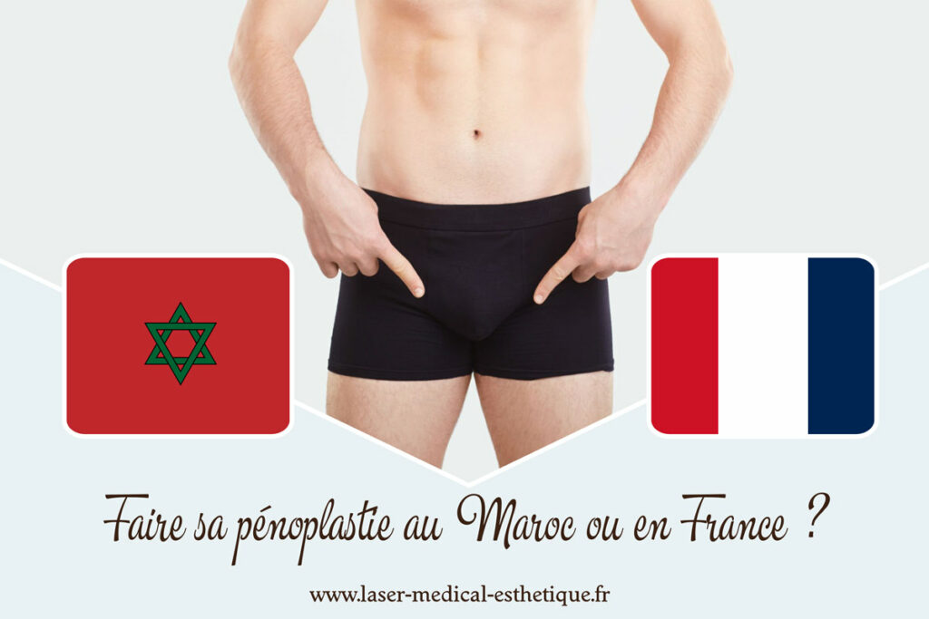 Faire sa pénoplastie au Maroc ou en France ? Faire sa pénoplastie au Maroc ou en France