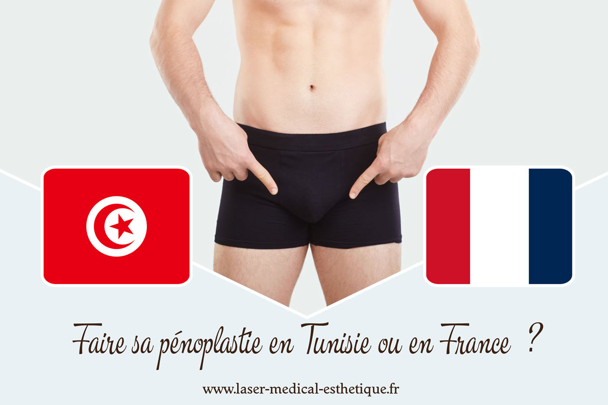 Faire sa pénoplastie en Tunisie ou en France ? Faire sa pénoplastie en Tunisie ou en France