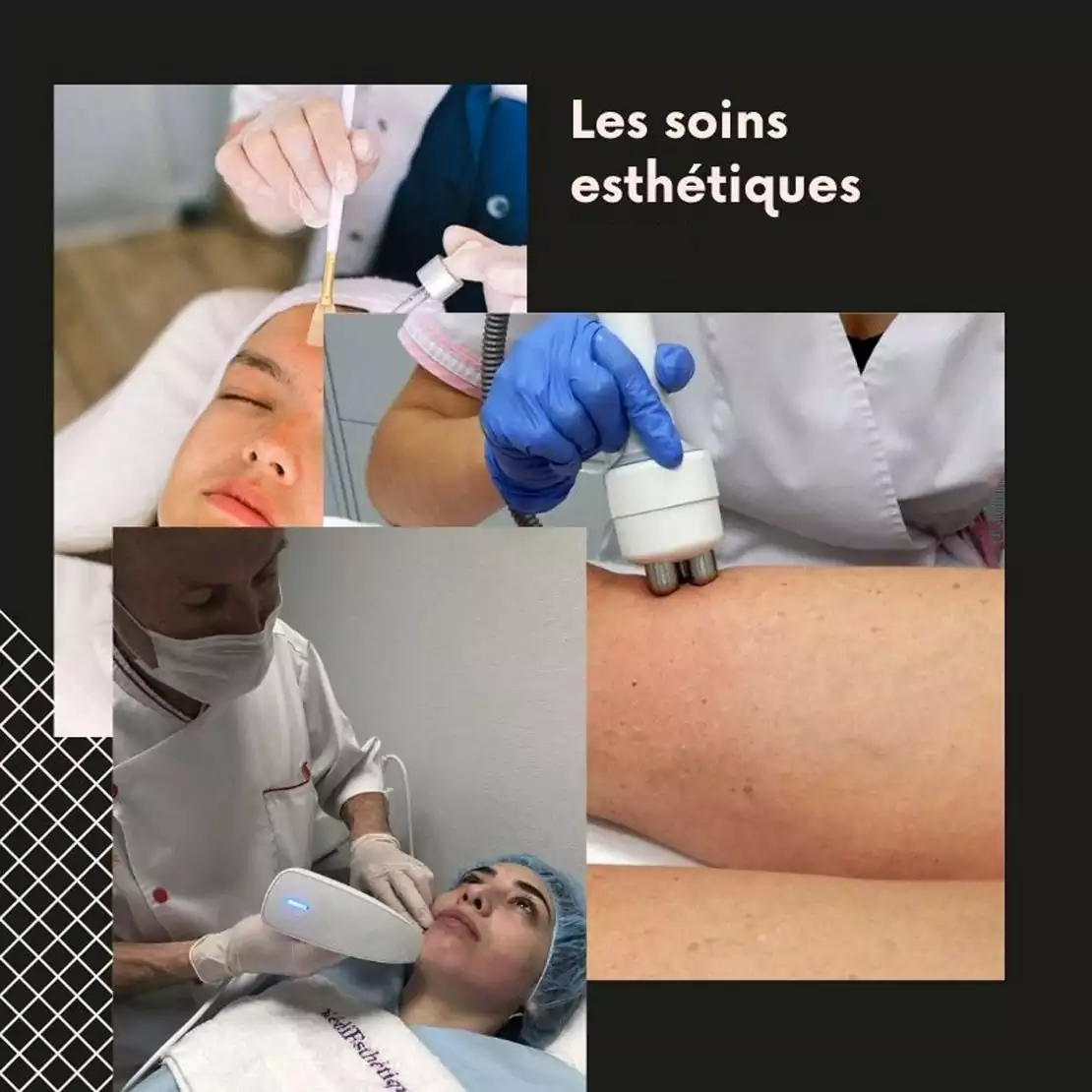 Les soins esthétiques comme solution durable aux imperfections cutanées