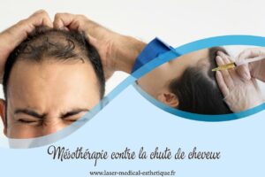 Mésothérapie contre la chute de cheveux