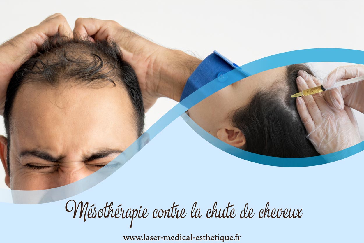 Mésothérapie contre la chute de cheveux Mésothérapie contre la chute de cheveux