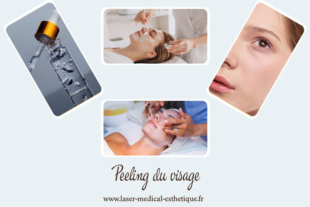 Peeling du visage