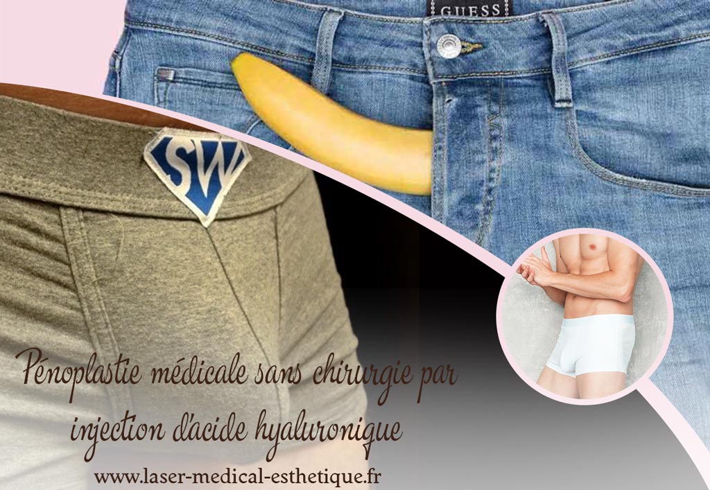 Pénoplastie médicale sans chirurgie par injection d'acide hyaluronique Pénoplastie médicale sans chirurgie par injection acide hyaluronique