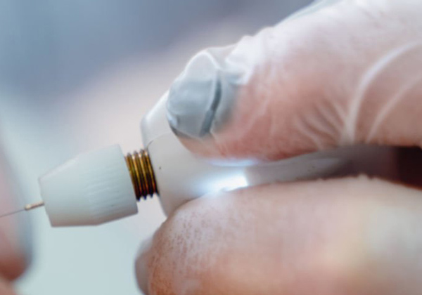 Traitements des grains de Fordyce sur la vulve PlexR pour le traitement des grains de Fordyce