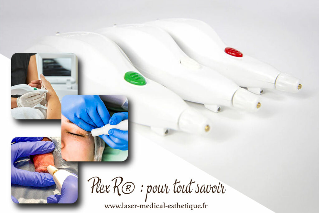 PlexR® : pour tout savoir Plex,pour tout savoir