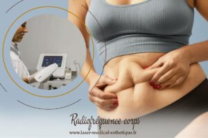 Radiofréquence corps