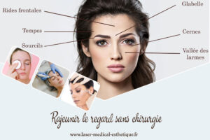 Rajeunir le regard sans chirurgie