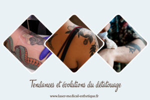 Tendances et évolutions du détatouage