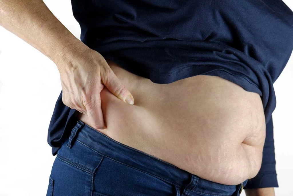 Traitement de la cellulite par la mésothérapie Traitement de la cellulite par la mésothérapie