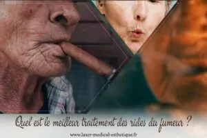 Traitement des rides du fumeur