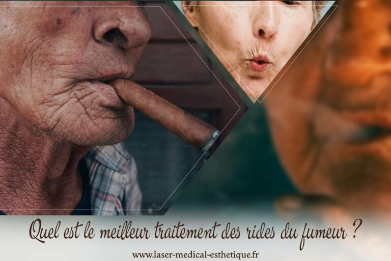 Traitement des rides du fumeur