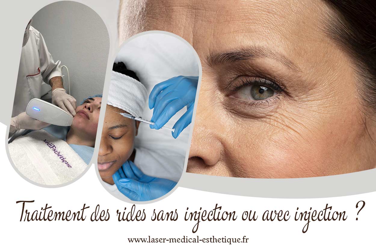 Traitement des rides sans injection ou avec injection ? Traitement des rides sans injection ou avec injection