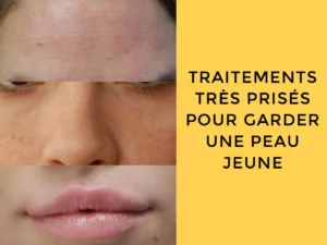 Traitements très prisés pour garder une peau jeune