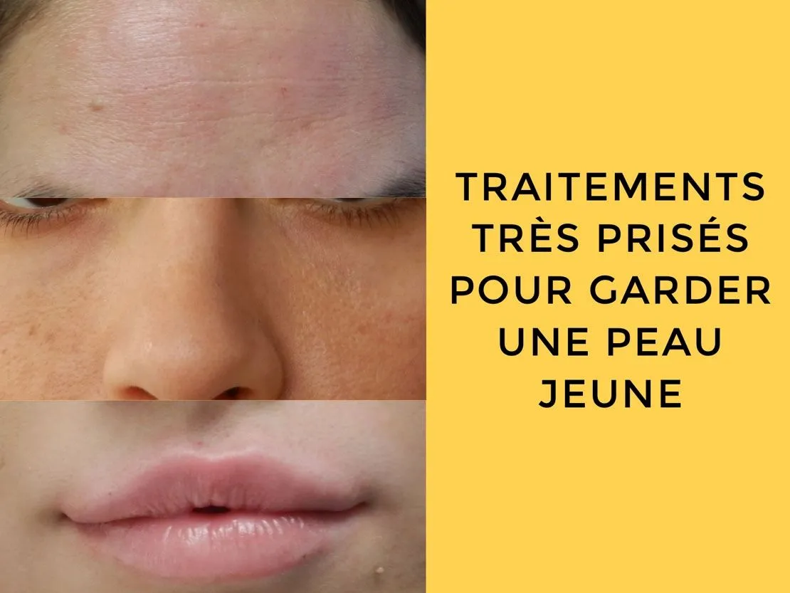 Traitements très prisés pour garder une peau jeune