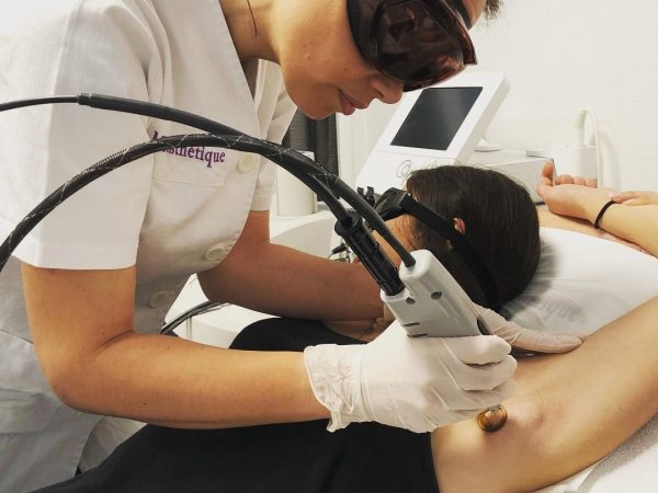 Epilation laser des aisselles au cabinet du Dr Didier Dubois Angers Epilation laser des aisselles au cabinet du Dr Didier Dubois Angers