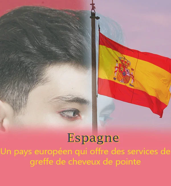 Greffe de cheveux en Espagne