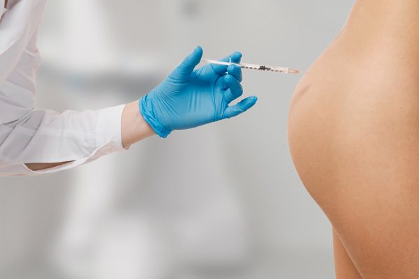 Injections d’acide hyaluronique fessier
