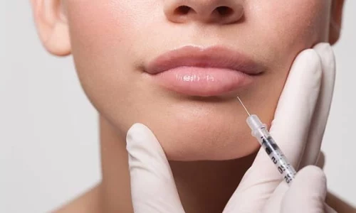 utilisation d'un micro-canule pendant l'injection d'acide hyaluronique