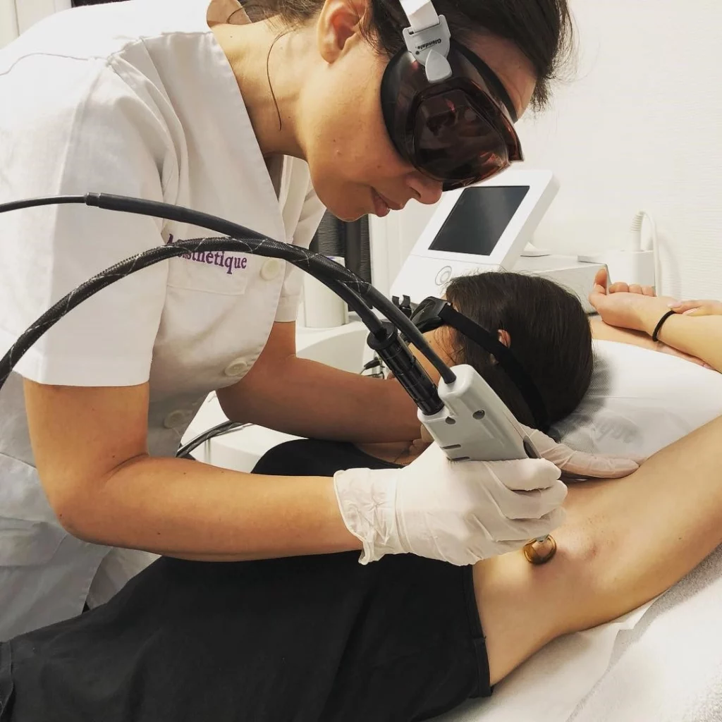 Epilation laser des aisselles Epilation laser des aisselles au cabinet du dr Didier Dubois angers