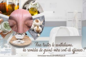 xanthélasma remèdes de grand-mère