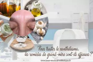 Traitement des papules perlées du gland xanthélasma remèdes de grand-mère